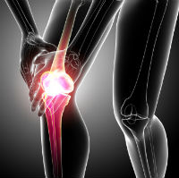 Новый медицинский центр в  Ассуте™: протезирование коленного сустава проводится по индивидуальному заказу 