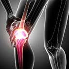 Новый медицинский сервис в Ассуте™: протезирование коленного сустава по индивидуальному заказу